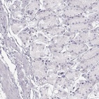 Anti-MILR1 Antibody