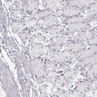 Immunohistochemical staining of human stomach shows low expression as expected.