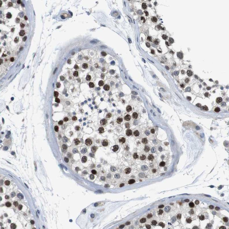 Anti-SMCO2 Antibody