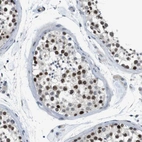 Anti-SMCO2 Antibody