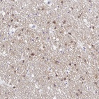 Anti-OPALIN Antibody