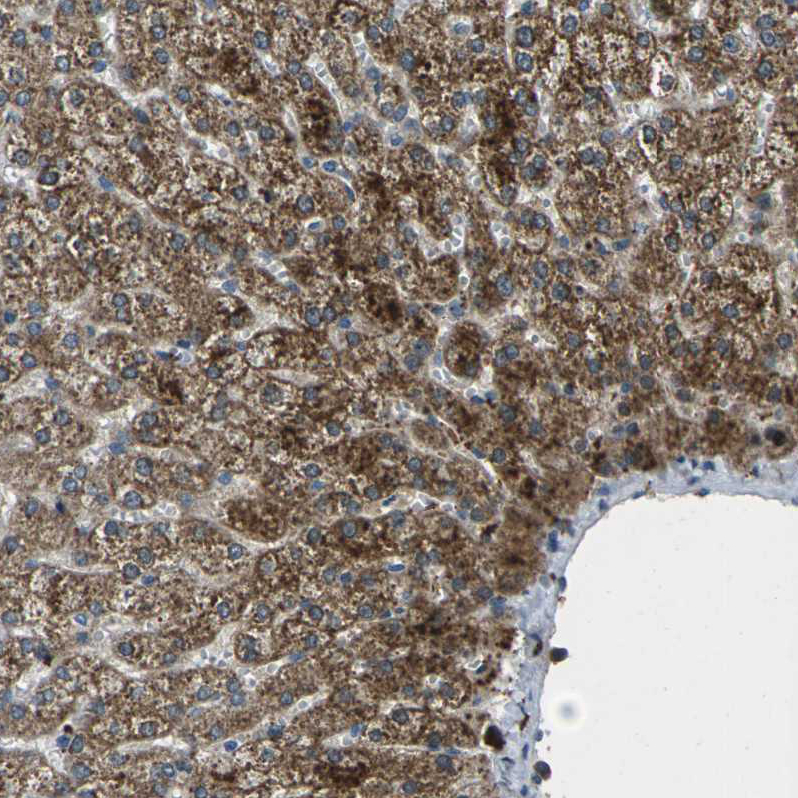 Anti-SIGLEC14 Antibody
