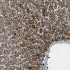 Anti-SIGLEC14 Antibody