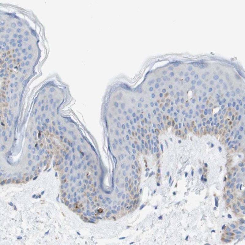 Anti-SDR42E1 Antibody