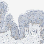 Anti-SDR42E1 Antibody