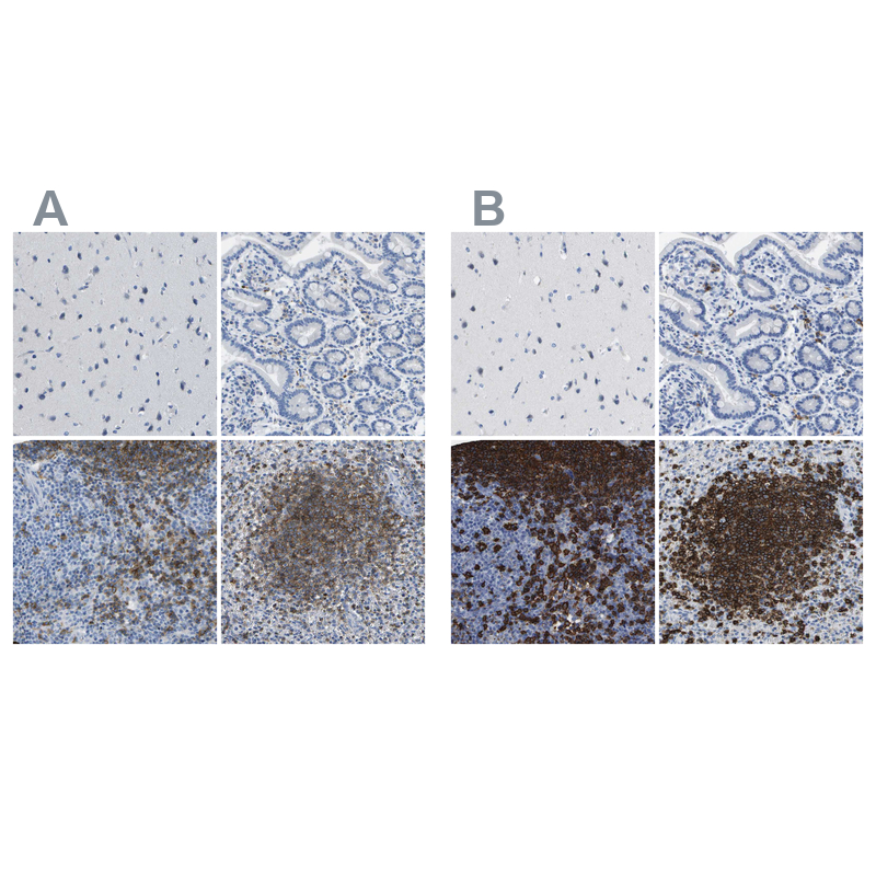Anti-MS4A1 Antibody