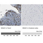 Anti-MS4A1 Antibody