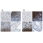 Immunohistochemical staining of human cerebral cortex, lymph node, spleen and testis using Anti-MS4A1 antibody HPA014391 (A) shows similar protein distribution across tissues to independent antibody HPA014341 (B).