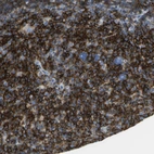 Immunohistochemical staining of human tonsil shows strong membranous positivity in germinal center cells.