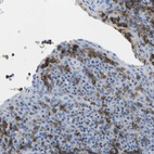 Immunohistochemical staining of human tonsil shows high expression.