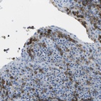 Anti-MS4A1 Antibody