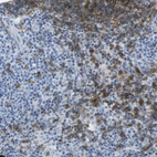 Immunohistochemical staining of human lymph node shows moderate membranous positivity in germinal center cells.
