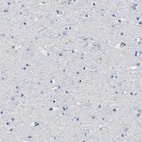 Immunohistochemical staining of human cerebral cortex shows low expression as expected.