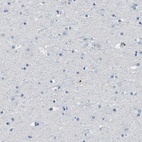 Anti-MS4A1 Antibody