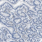Immunohistochemical staining of human duodenum shows moderate membranous positivity in lymphoid cells.