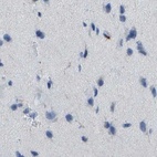 Immunohistochemical staining of human cerebral cortex using Anti-MS4A1 antibody HPA014391.