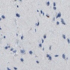 Anti-MS4A1 Antibody