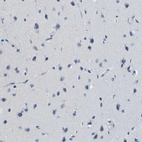 Immunohistochemical staining of human cerebral cortex shows no positivity in neurons as expected.