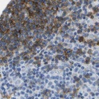 Immunohistochemical staining of human lymph node using Anti-MS4A1 antibody HPA014391.