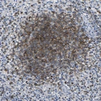 Immunohistochemical staining of human spleen shows strong membranous positivity in cells in white pulp.