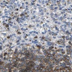 Immunohistochemical staining of human spleen using Anti-MS4A1 antibody HPA014391.
