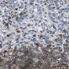 Anti-MS4A1 Antibody