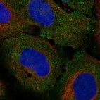 Anti-GJB7 Antibody