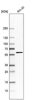 Western blot analysis in human cell line RH-30.