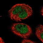 Anti-NEMP1 Antibody