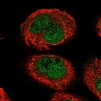 Immunofluorescent staining of human cell line A-431 shows localization to nucleoplasm.