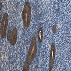 Anti-TMEM200A Antibody