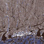 Immunohistochemical staining of human cerebellum shows strong cytoplasmic positivity in Purkinje cells.