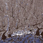 Immunohistochemical staining of human cerebellum shows strong cytoplasmic positivity in Purkinje cells.