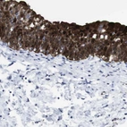Immunohistochemical staining of human urinary bladder shows strong cytoplasmic positivity in urothelial cells.