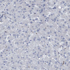 Immunohistochemical staining of human liver shows no positivity in hepatocytes as expected.