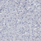 Immunohistochemical staining of human liver shows no positivity in hepatocytes as expected.