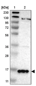 Lane 1: Marker [kDa] 230, 130, 95, 72, 56, 36, 28, 17, 11_br/_Lane 2: Human cell line RT-4