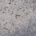 Immunohistochemical staining of human cerebellum shows strong cytoplasmic positivity in glial cells.