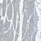 Immunohistochemical staining of human skeletal muscle shows no positivity in myocytes as expected.