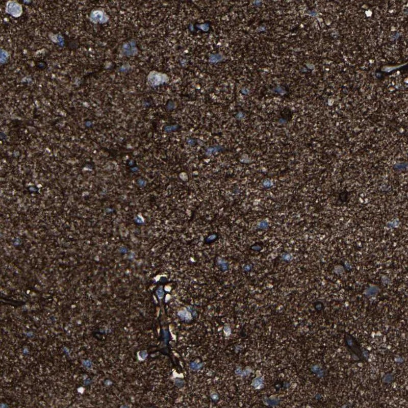 Anti-MSANTD4 Antibody
