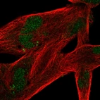 Immunofluorescent staining of human cell line RH-30 shows localization to nucleus.