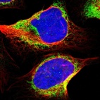 Immunofluorescent staining of human cell line U-2 OS shows localization to endoplasmic reticulum.
