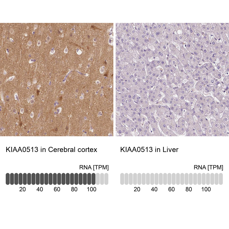 Anti-KIAA0513 Antibody