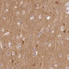 Immunohistochemical staining of human cerebral cortex shows high expression.