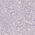 Immunohistochemical staining of human liver shows low expression as expected.