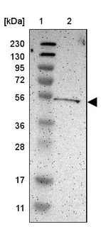 Lane 1: Marker [kDa] 230, 130, 95, 72, 56, 36, 28, 17, 11_br/_Lane 2: Human cell line RT-4