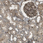 Immunohistochemical staining of human kidney shows moderate cytoplasmic positivity in cells in glomeruli.