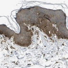 Immunohistochemical staining of human skin shows moderate cytoplasmic positivity in squamous epithelial cells.