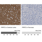 Anti-PRRT2 Antibody