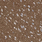 Immunohistochemical staining of human cerebral cortex shows strong positivity in neuropil.